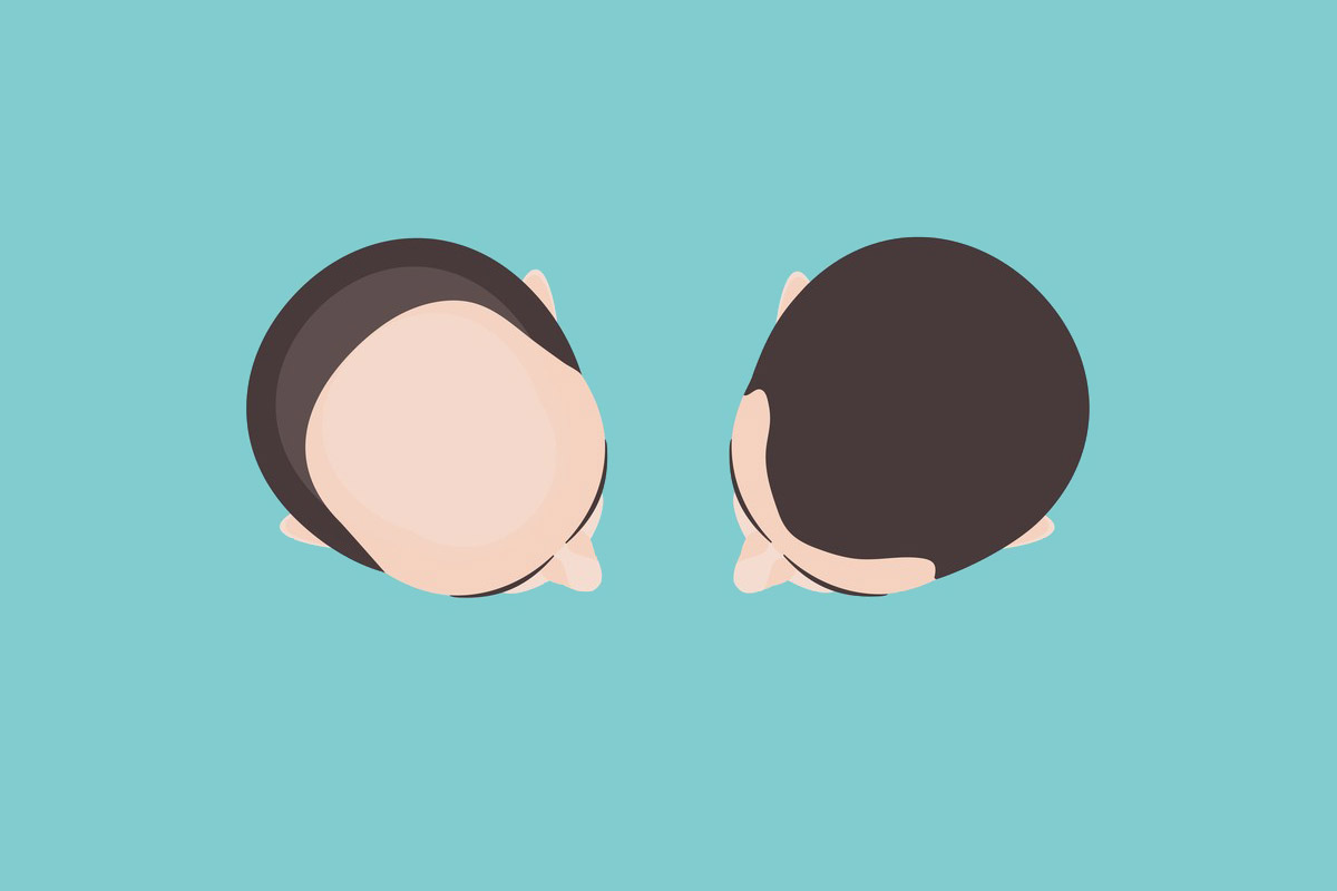 Hair transplant guide